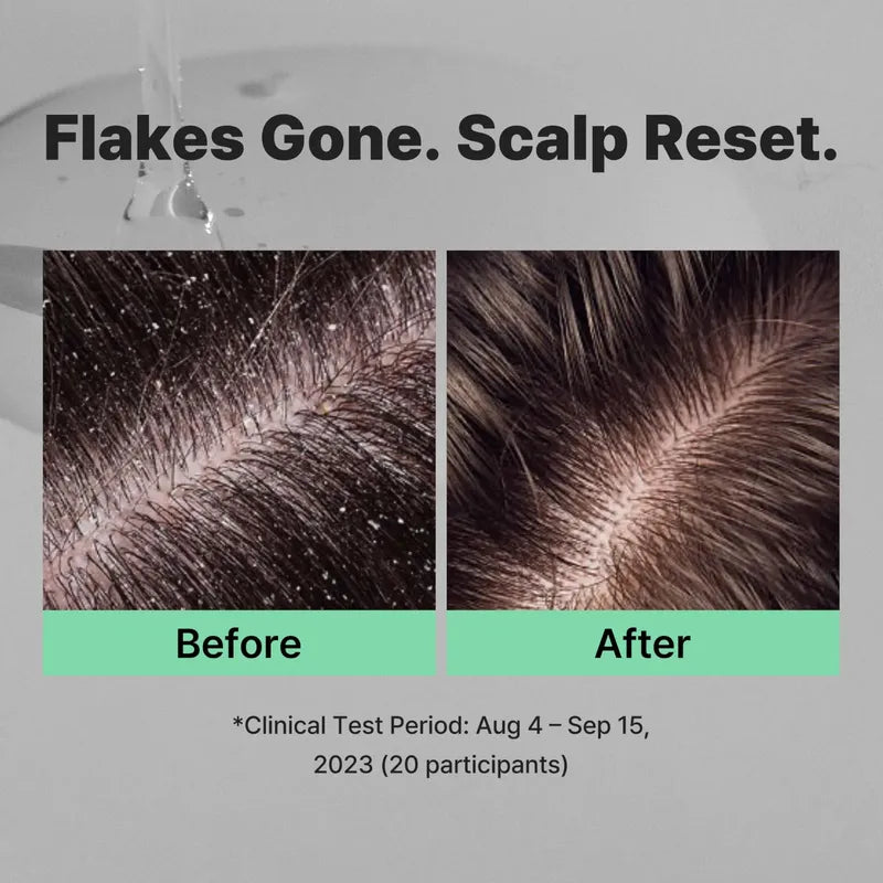 Minoxell Shampoo Coreano Caspa Refresca Exfoliante Anticaida