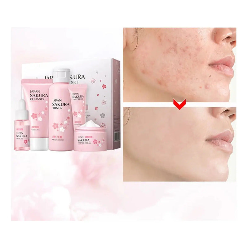 Set Skincare Japones 4 Pzs Cuidado De La Piel Sakura Sweet Kiss Laikou Rutina Basica