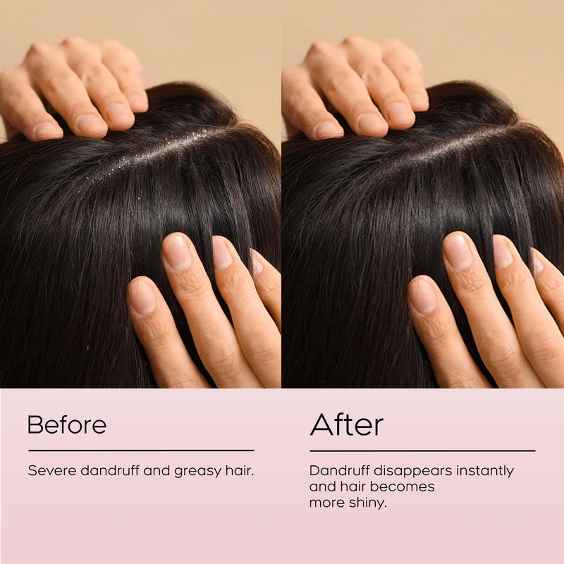 Shampoo Coreano Forest Story Biotina Anticaspa Quita Comezón